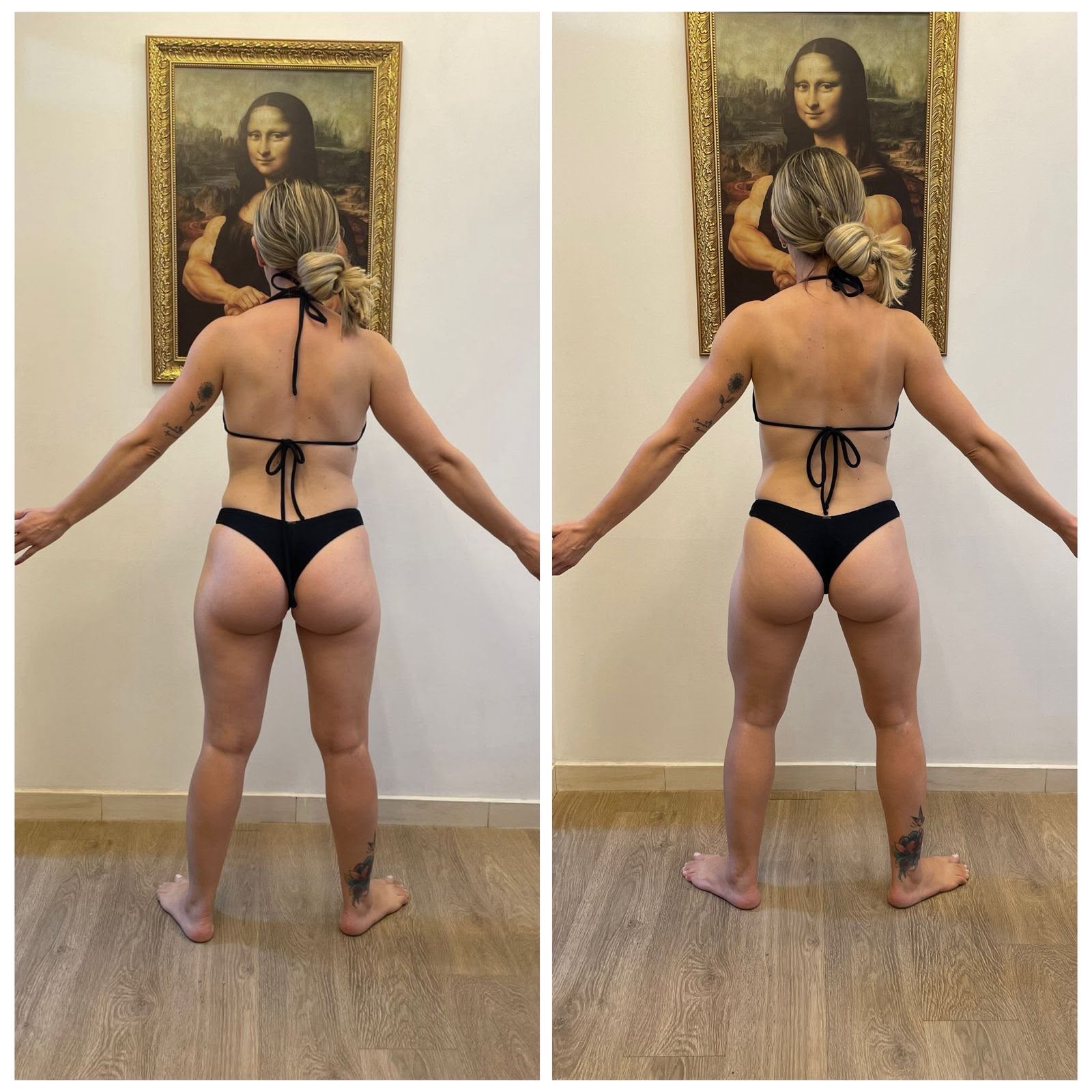 Aline: 4 meses de acompanhamento